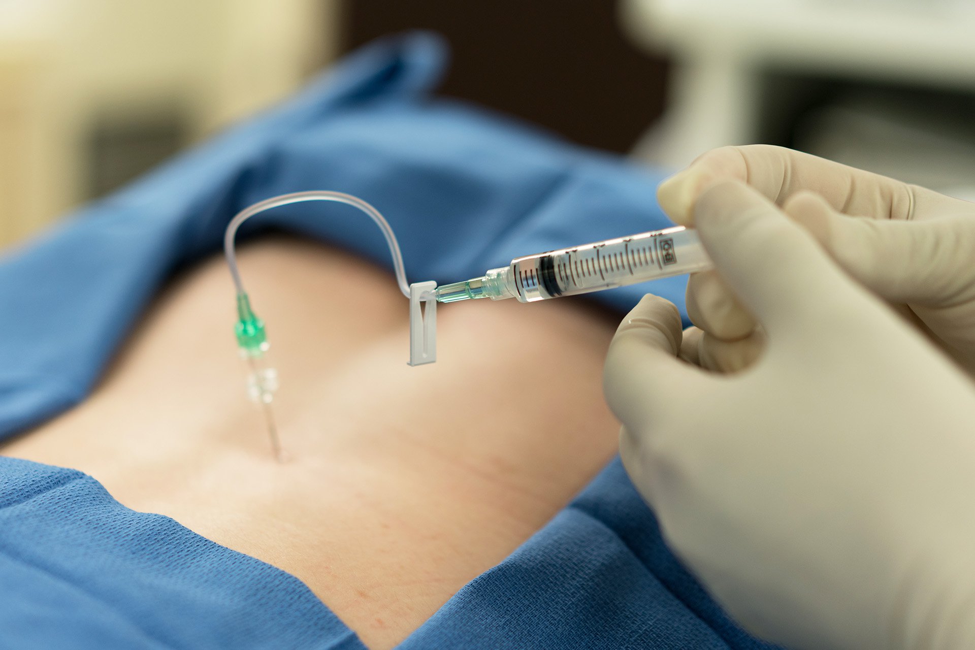 Inyección epidural